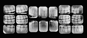 x-rays photo